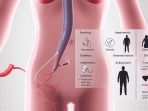 Faktor-Risiko-Trombosis-Arteri